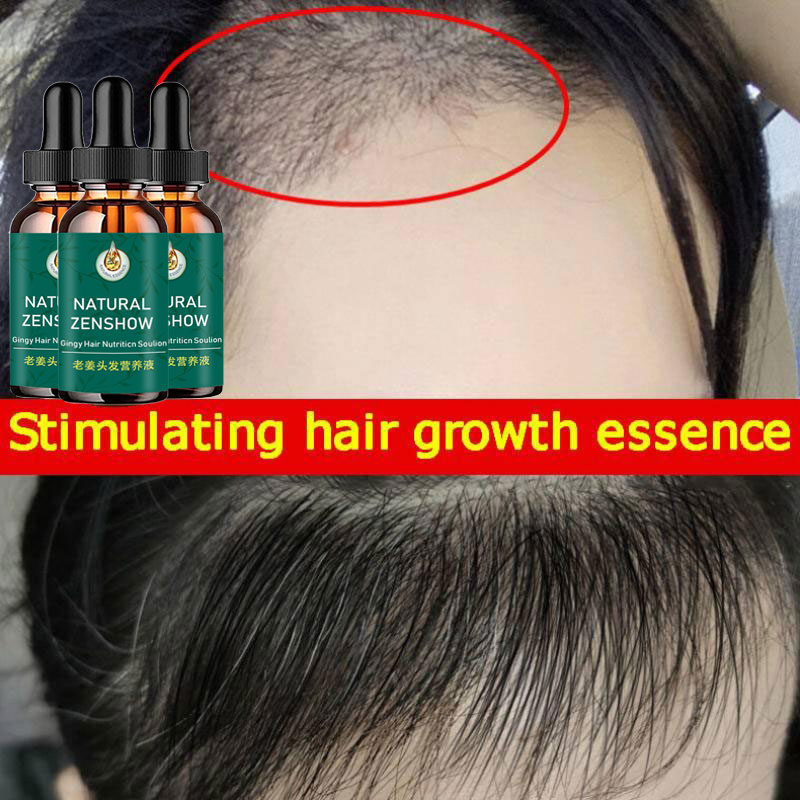 زيت عطري لنمو الشعر بالزنجبيل  - مراجعة Hair Care Herbal وسعره