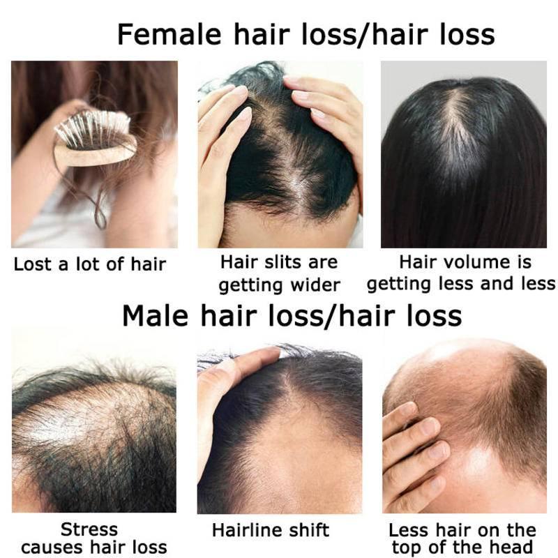 زيت عطري لنمو الشعر بالزنجبيل  - مراجعة Hair Care Herbal وسعره