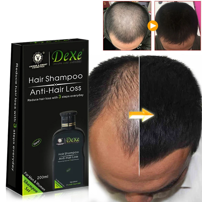 شامبو احترافي لنمو الشعر مضاد  - مراجعة Hair Care Herbal وسعره