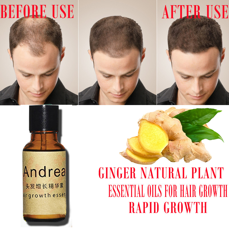 2/5/10 قطعة أندريا زيت مصل نمو - مراجعة Hair Care Herbal وسعره
