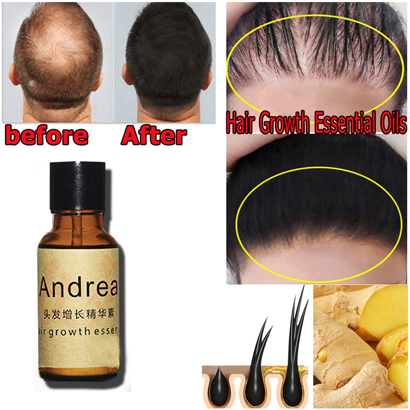 2/5/10 قطعة أندريا زيت مصل نمو - مراجعة Hair Care Herbal وسعره